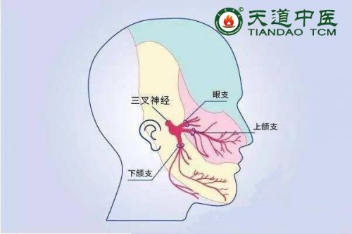 三叉神经痛中药外治