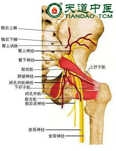 坐骨神经痛